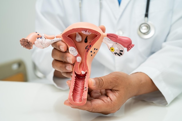 Médico de útero con modelo de anatomía para el estudio de diagnóstico y tratamiento en el hospital