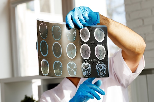 Médico varón examina la resonancia magnética del cerebro de un paciente en el hospital