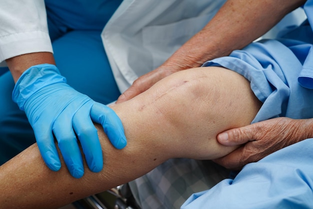 Foto médico verificando paciente idosa asiática com cirurgia de substituição do joelho cicatricial no hospital