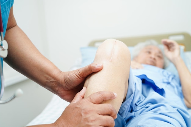 Médico verificando paciente idosa asiática com cirurgia de substituição do joelho cicatricial no hospital