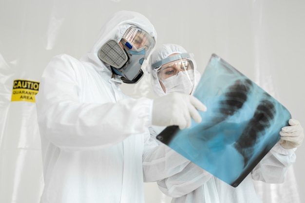 Foto médicos epidemiologistas examinam raio-x para pneumonia em um paciente com covid-19