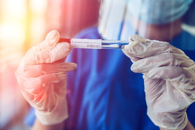 Medizinischer Arbeiter, der ein Reagenzglas mit Blutprobe hält, um ein neues Virus Coronavirus Covid 19 im Forschungslabor zu erkennen