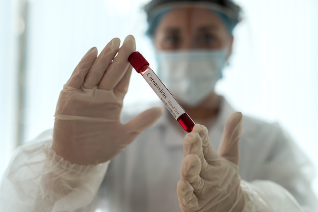 Medizinischer Mitarbeiter, der Patientenblutproben im Labor auf das Vorhandensein von Coronavirus untersucht