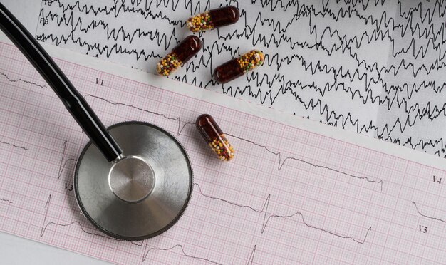 Medizinisches Stethoskop mit Pillen und Kardiogramm auf hellem Hintergrund. Ansicht von oben