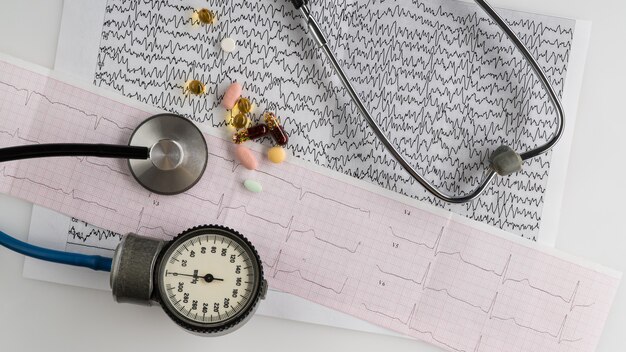 Medizinisches Stethoskop mit Tonometer und EKG auf hellem Hintergrund. Ansicht von oben