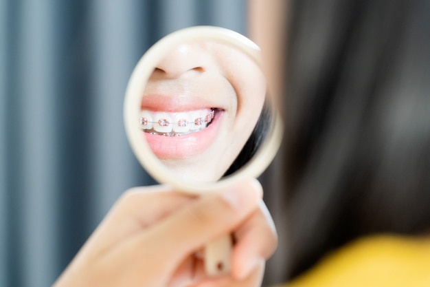 Menina com aparelho de dentes sorrindo e feliz