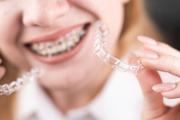 Menina com um sorriso lindo, segurando um protetor bucal transparente