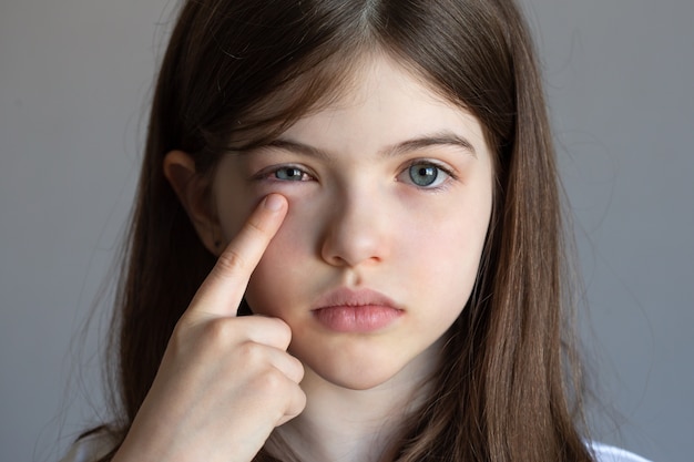 Foto menina tem dor nos olhos, lesão nos olhos, conjuntivite, alergias, uma criança tem olhos inchados