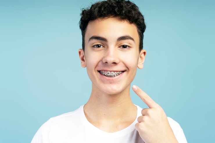 Foto menino atraente positivo com aparelhos ortopédicos apontando o dedo para a boca olhando para a câmera