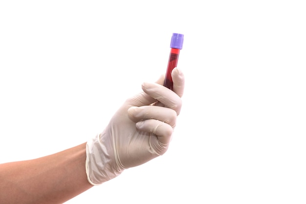 Menschliche Hände mit rotem Reagenzglas lokalisiert auf Weiß. Medizinisches Konzept