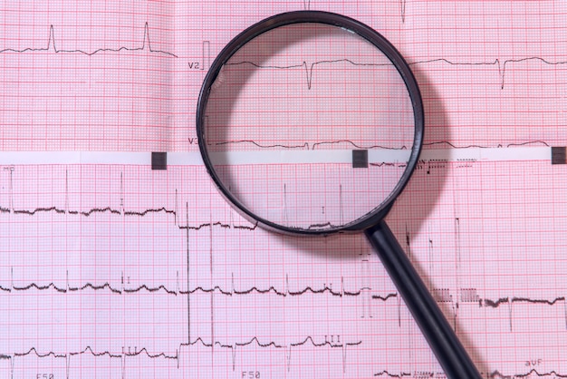 Mentira de lupa en hoja con electrocardiograma. Concepto médico.