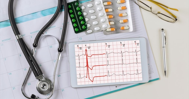 Mesa médica de mesa de trabalho com cardiograma cardíaco de onda na análise de relatório cardíaco do paciente