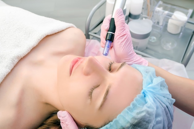 Mesoterapia com agulha. Cosmetologista realiza mesoterapia com agulha no rosto de uma mulher. Mulher bonita, recebendo tratamento de rejuvenescimento com microagulhamento. Levantamento de agulha