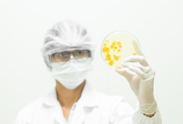 Microbiologista está segurando a placa de Petri com colônia amarela de fungos.