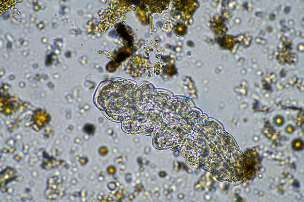 Microbios del suelo en un abono en una granja en India