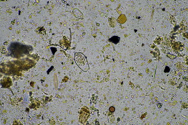 Foto microorganismos microscópicos bajo el microscopio