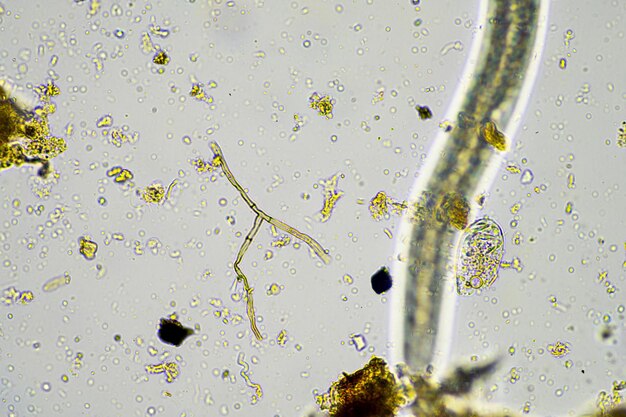 Foto microorganismos del suelo en una muestra de vida del suelo de una granja de agricultura sostenible red alimentaria viva o bacterias hongos y protozoos