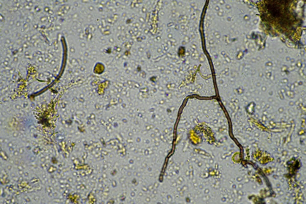 Microrganismos e biologia em amostra de composto e solo sob o microscópio