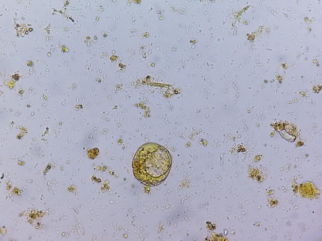 Mikroskopische Untersuchung des Stuhls, die den Parasiten Blastocystis hominis zeigt.