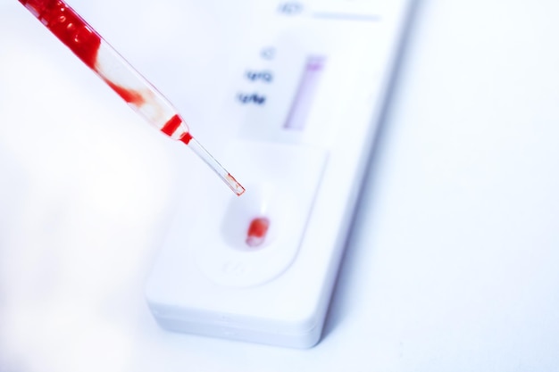 Foto mit blut pipettieren und auf antikörper gegen das coronavirus testen