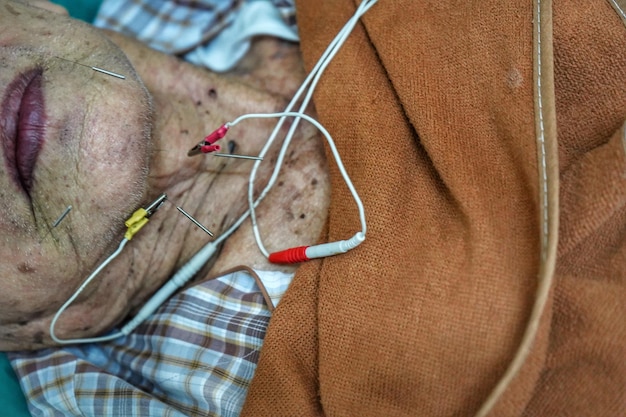 Foto mittelabschnitt eines älteren patienten im krankenhaus