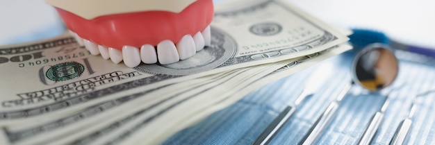 Modell der Zähne liegen auf dem Geld Nahaufnahme das Konzept der hohen Kosten für zahnärztliche Leistungen