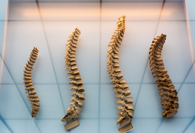 Foto modelo de columna vertebral humana, aprendizaje de la columna vertebral humana.