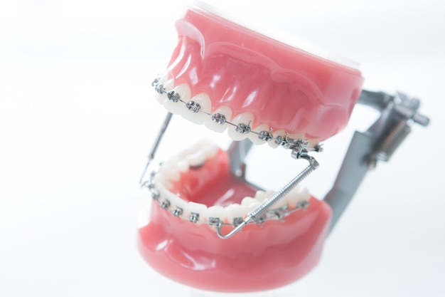 Modelo de aparelho dentário de suporte de mandíbula inferior em branco