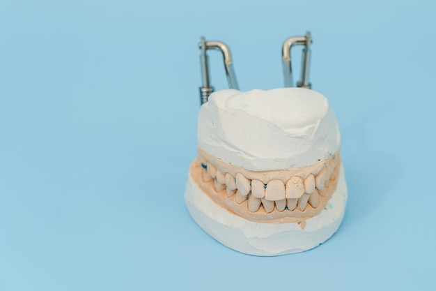Modelo de estudo de dentes e gengivas no conceito dental de fundo azul
