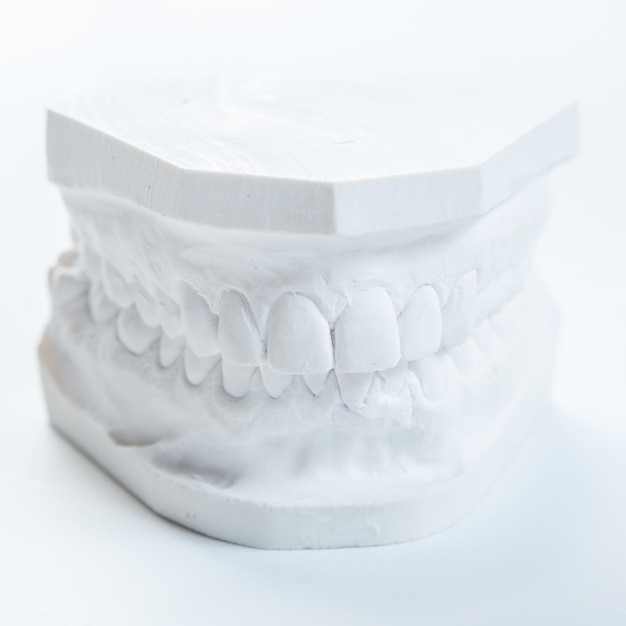 Modelo de gesso da mandíbula humana em um fundo branco