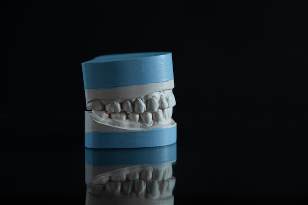 Foto modelo de gesso de dentes em fundo preto