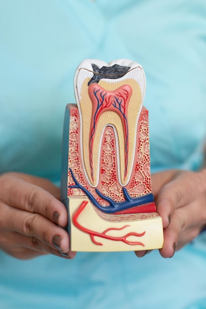 Modelo de imitação de uma incisão dentária com cárie e canais para tratamento nas mãos de um dente
