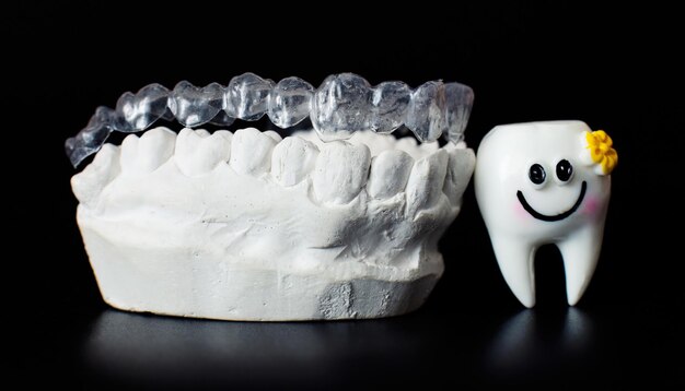 Modelo de mandíbula dentária sobre fundo preto Alinhadores ou aparelhos dentários invisíveis transparentes aplicáveis a um tratamento dentário ortodôntico