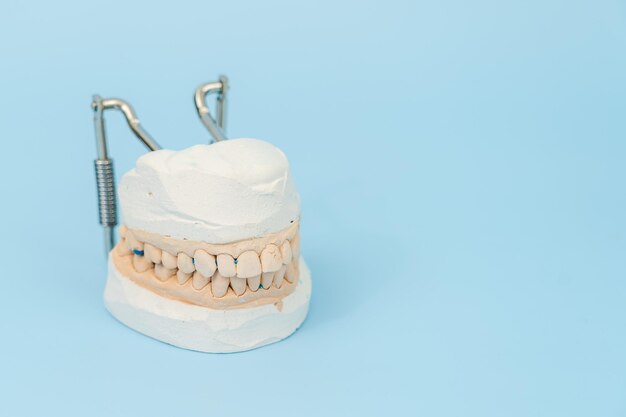 Modelo de dientes y encías sobre fondo azul Concepto dental
