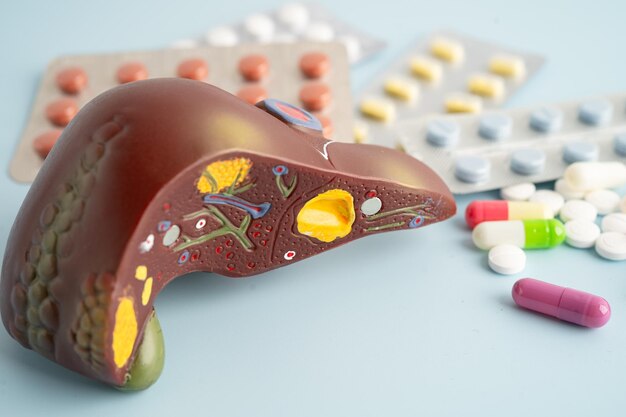 Modelo hepático con tratamiento con pastillas Cirrosis Cáncer de hígado hígado graso