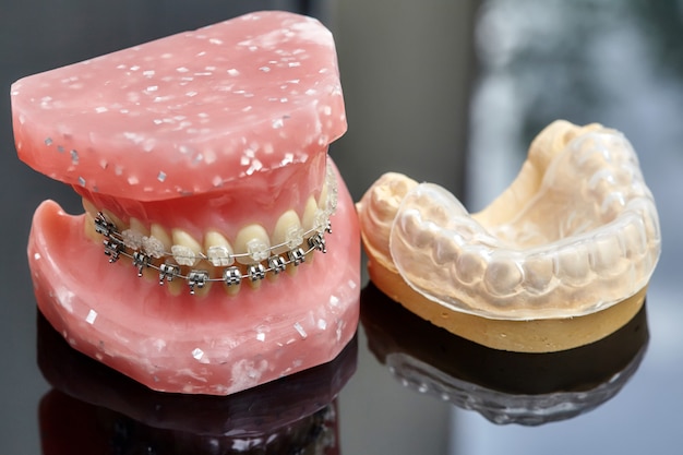 Modelo humano de mandíbula ou dentes com aparelho dental com fio de metal