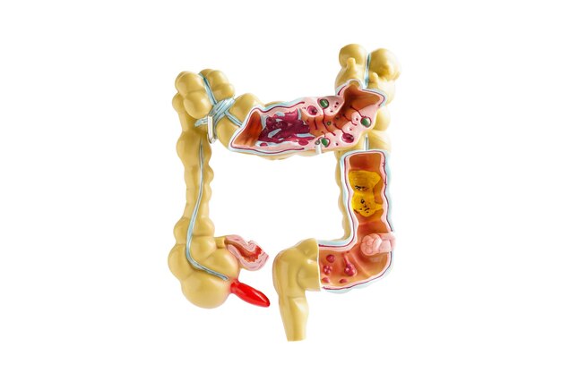 Modelo de intestino aislado sobre fondo blanco con trazado de recorte médico que sostiene el modelo de anatomía para el estudio de diagnóstico y tratamiento en el hospital