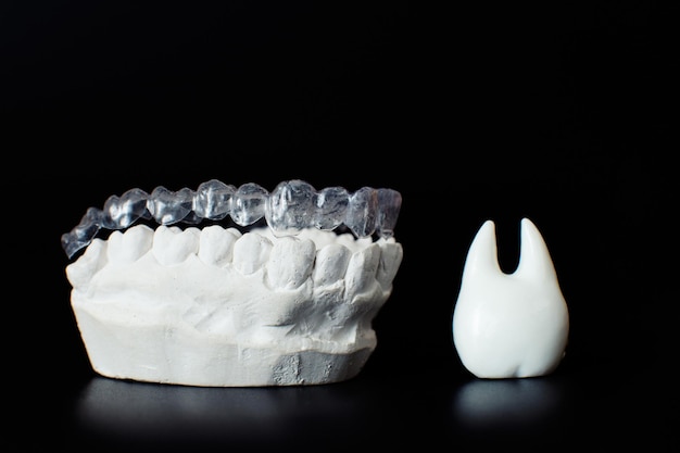 Modelo de mandíbula dental sobre fondo negro Alineadores dentales invisibles transparentes o aparatos ortopédicos aplicables para un tratamiento dental de ortodoncia