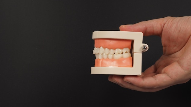 Modelo de ortodoncia de dientes en mano sobre fondo negro.