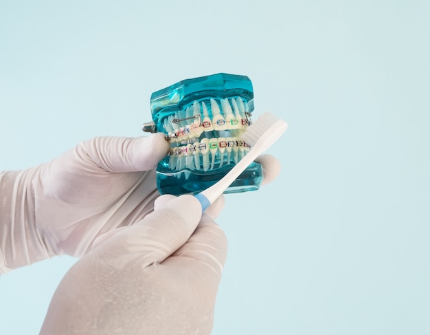 Foto modelo de ortodoncia y herramienta de dentista: modelo de demostración de dientes de diversas variedades de brackets o corsé de ortodoncia
