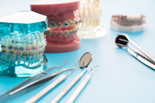 Modelo de ortodoncia y herramienta de dentista - modelo de dientes de demostración de variedades de ortodoncia