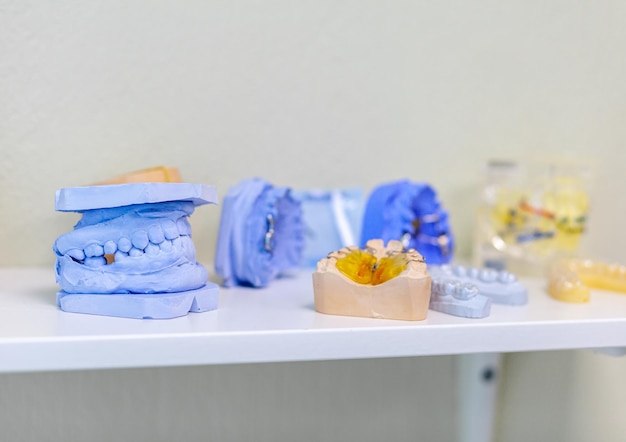 Modelos de gesso dental fundidos de uma mandíbula dental humana Os modelos de gesso encontram-se em uma prateleira em uma fileira de próteses