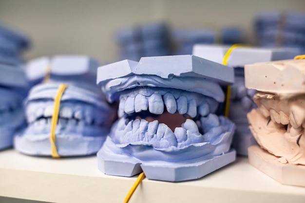 Modelos de gesso dental fundidos de uma mandíbula dental humana Os modelos de gesso encontram-se em uma prateleira em uma fileira de próteses