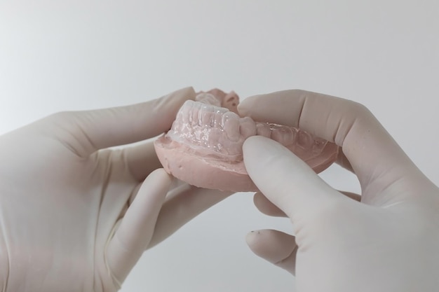 Foto moldes para blanquear los dientes colocados en materiales de impresión dental alginato.