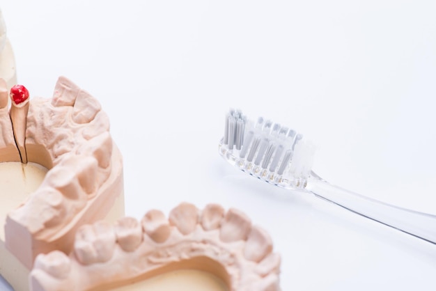 Moldes de dentes com escova de dentes em uma mesa branca brilhante