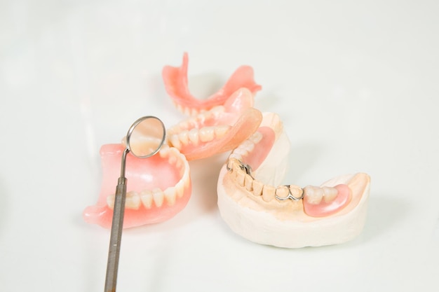 Moldes de dentaduras postizas de celusti y espejo estomatologico