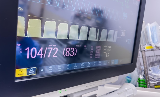 monitor de hospital exibindo sinais vitais enfatizando a tecnologia de cuidados de saúde e o bem-estar do paciente