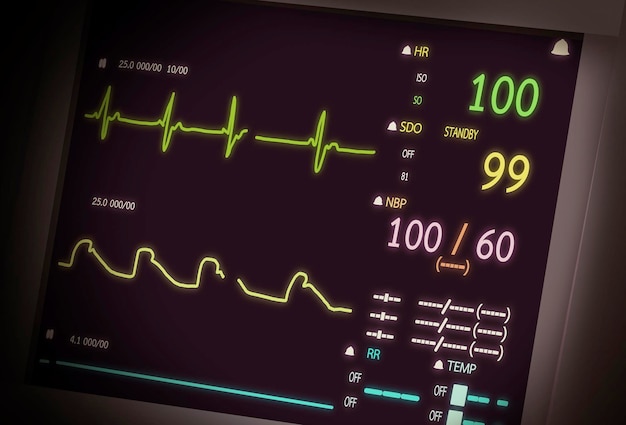 Monitor de paciente mostrando sinais vitais ecg e ekg. ilustração vetorial