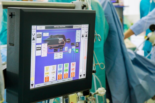 Monitor de derivación cardiopulmonar aparato de circulación sanguínea artificial en la unidad de cuidados intensivos