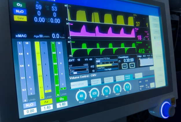 El monitor del hospital muestra los signos vitales, la frecuencia cardíaca, la presión arterial, los niveles de oxígeno, cruciales para el paciente.